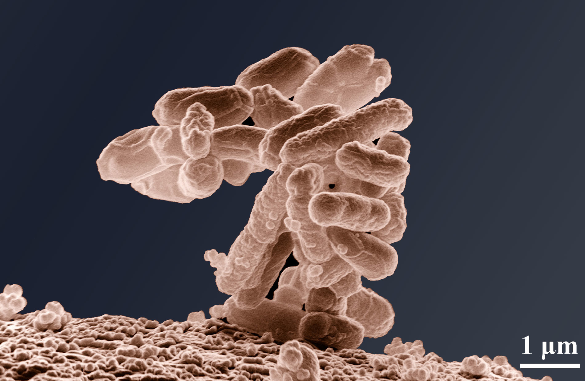 Низкотемпературная электронная микрофотография кластера E. coli. Фото: © Wikipedia