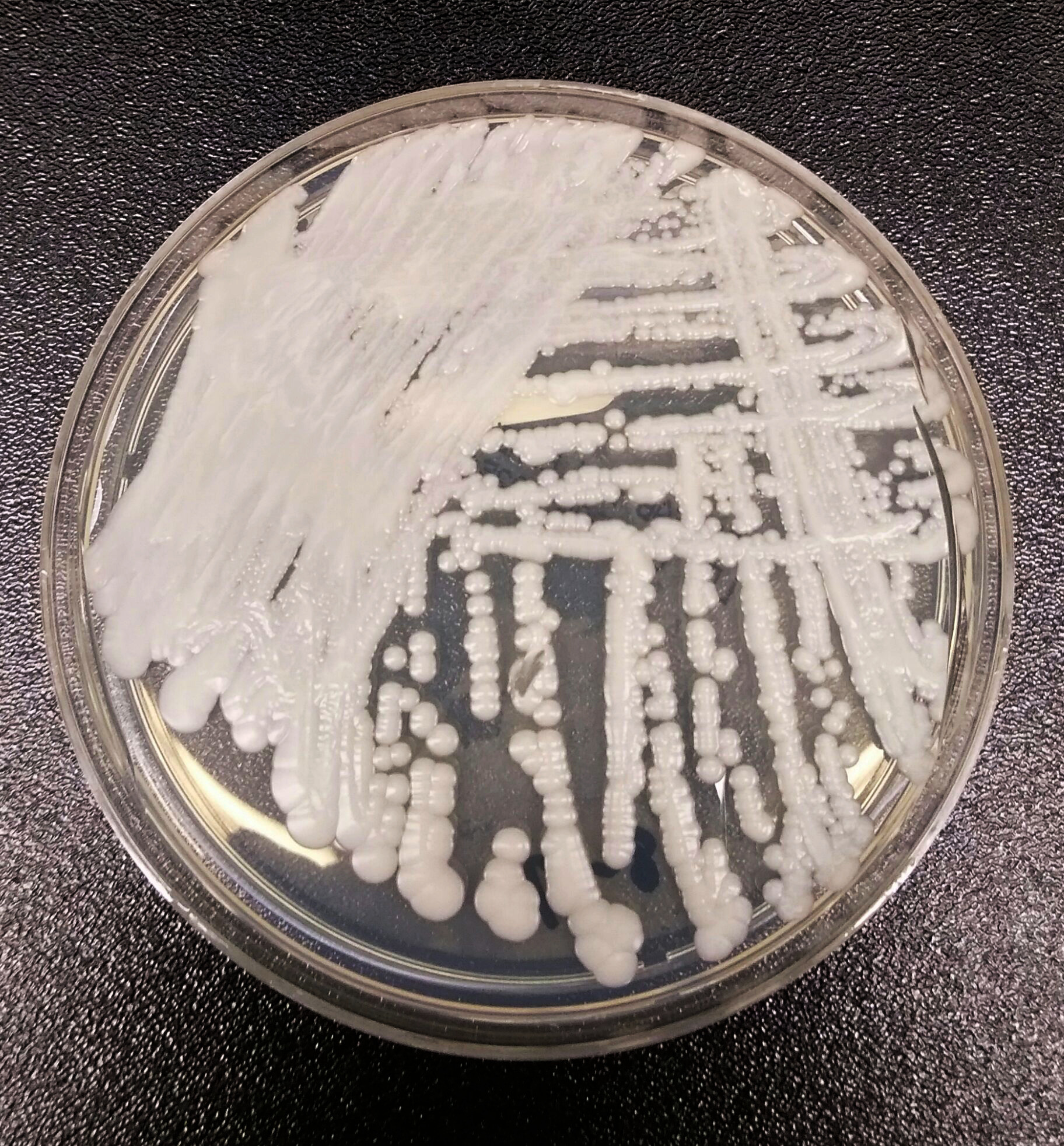 Штамм Candida auris, культивированный в чашке Петри в лаборатории Центров по контролю и профилактике заболеваний США. Фото: © phil.cdc.gov