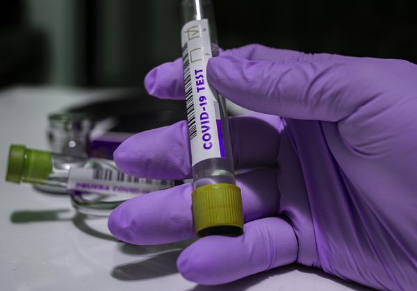 Итальянские учёные выяснили правду о смертности от коронавируса