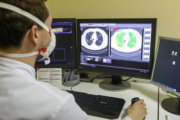 В Москве собрана крупнейшая в мире база компьютерных томограмм пациентов с коронавирусом