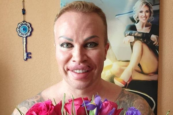 Блогер Саша Шпак показал, как выглядел до всех татуировок, имплантов в грудь и перекачанных губ
