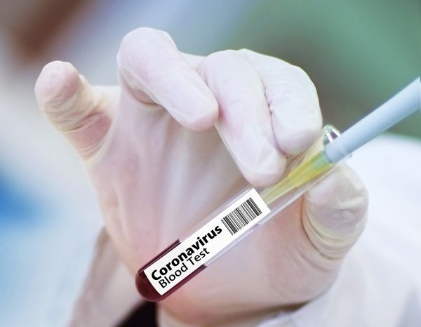 В ВОЗ назвали российскую вакцину от коронавируса безопасной и эффективной