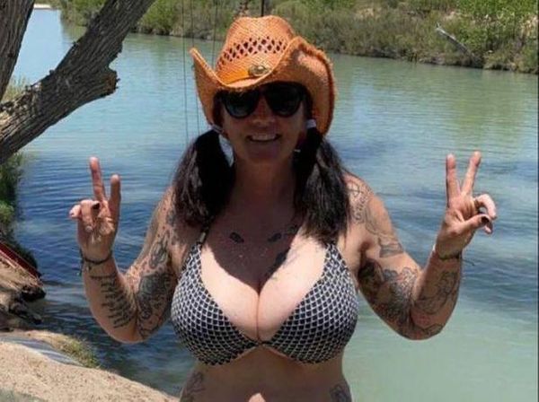 Имплант разорвался прямо в груди клиентки, и врачи были уверены, что ей осталось жить 6 месяцев