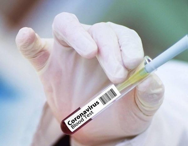 Китай назвал стоимость своей вакцины от коронавируса. Недёшево