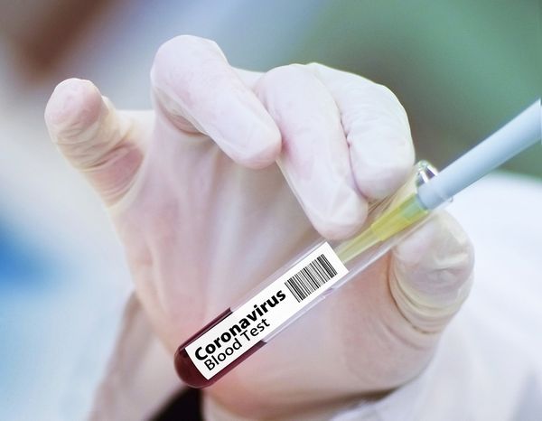Минздрав зарегистрировал вакцину от коронавируса в форме порошка