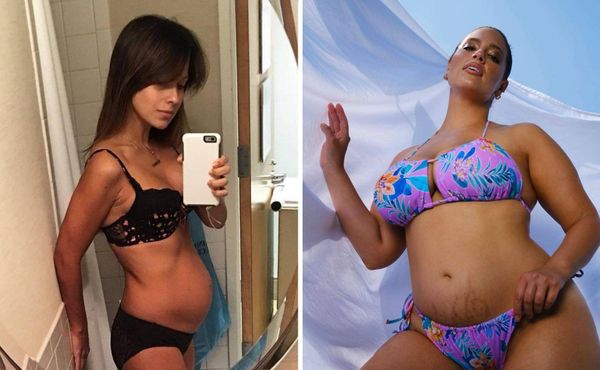 10 знаменитостей, которые честно показали, как выглядит их тело после родов
