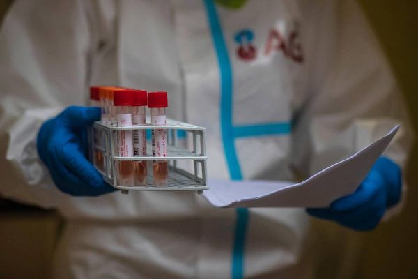 Российские специалисты предложили лечить коронавирус как отравление ядом