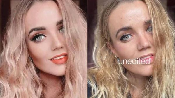 Дочь известного ведущего раскрыла жестокие законы соцсетей, показав себя до и после ретуши