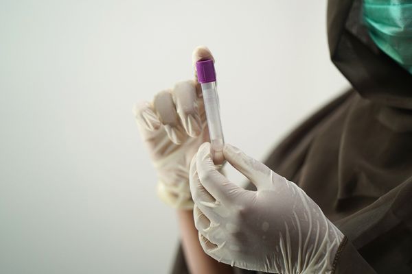 Врачи зафиксировали первый в мире случай смерти из-за повторного заражения коронавирусом