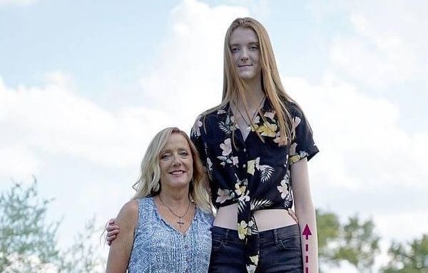 17-летняя девушка побила рекорд Гиннесса, и теперь её ноги признаны самыми длинными на планете