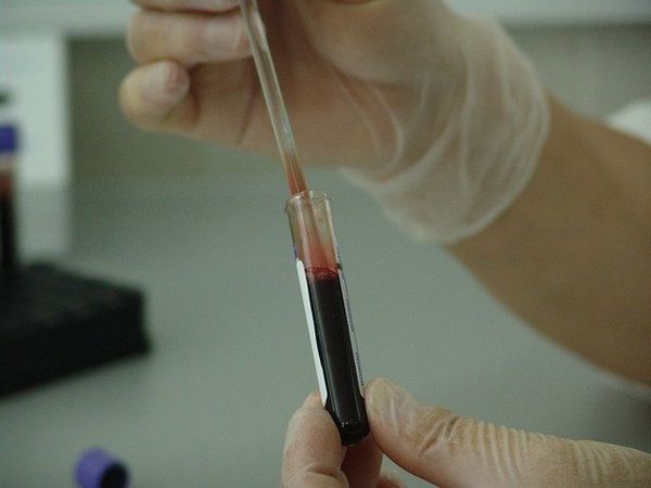Около двух тысяч москвичей уже сдали тест на антитела к коронавирусу
