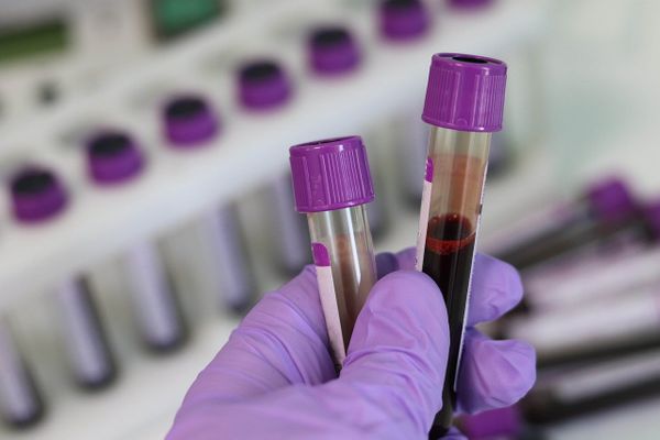 Тест на антитела к коронавирусу в Москве через несколько недель сможет сдать любой желающий