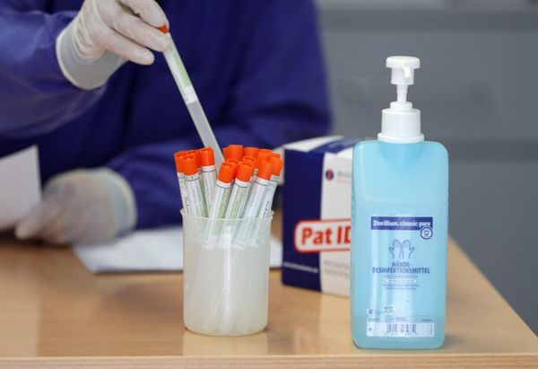 Две российские сети лабораторий начнут делать тесты на антитела к коронавирусу