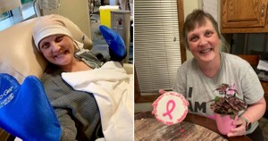 Пациенты показали, как преобразилась их жизнь, когда рак был окончательно побеждён: 10 фото до и после