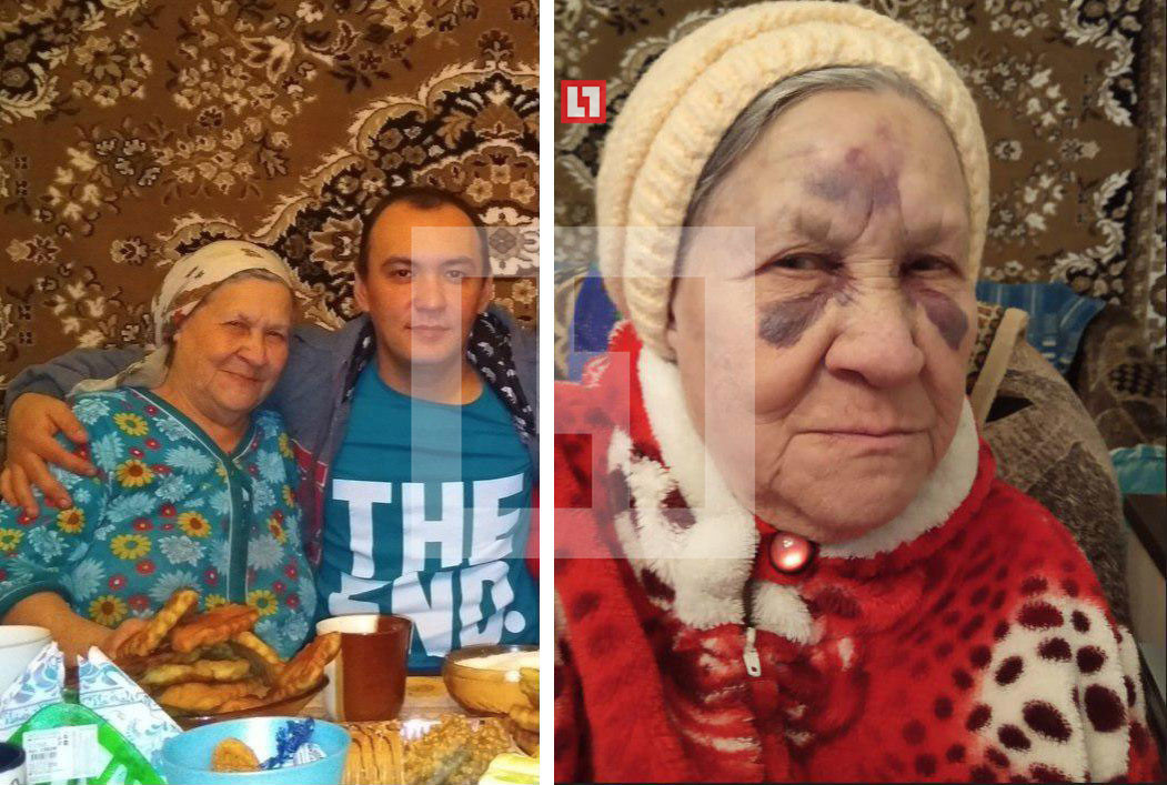 Фото: © Личные фотографии женщины до и после инцидента