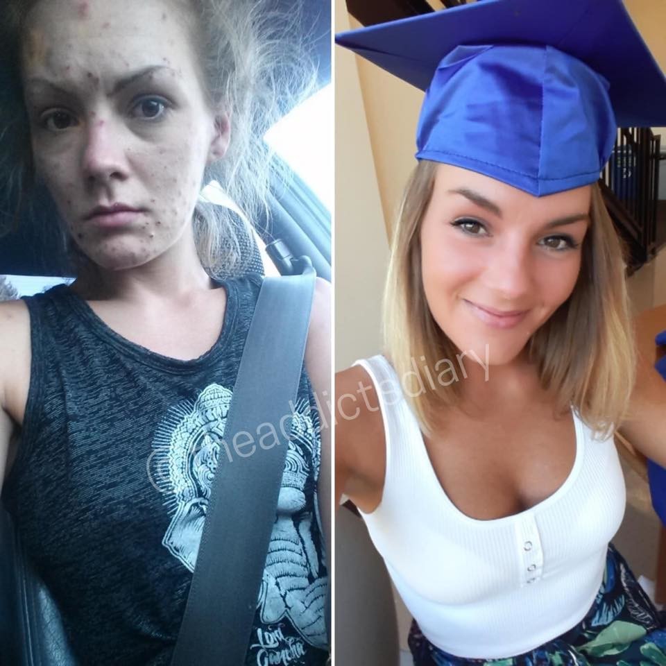 Слева Джейми в 2017 году, справа — в 2019-м. Фото © Facebook / The Addict's Diary