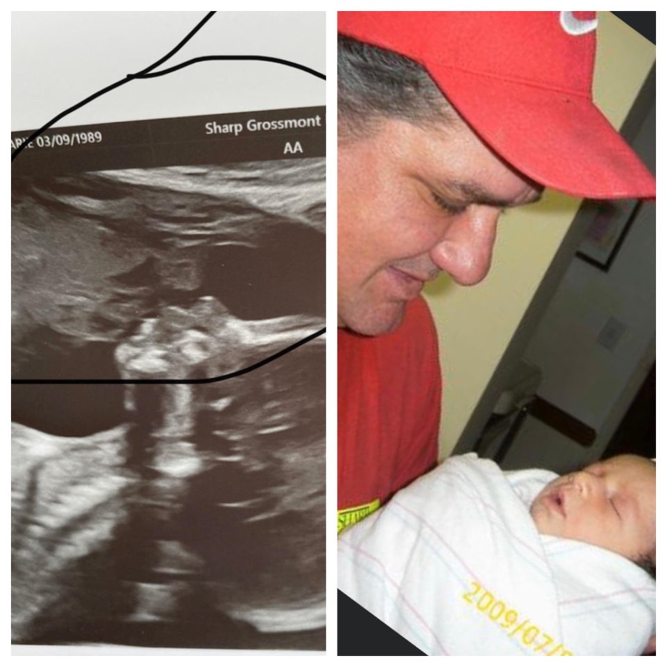 Фото © Reddit / My late father showing up in my second daughter’s ultrasound
