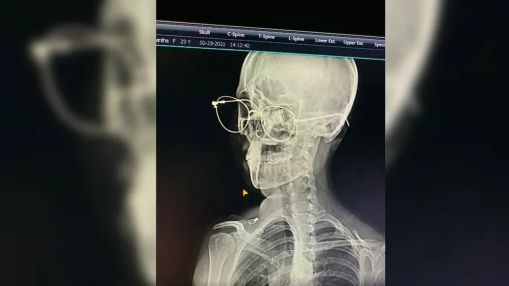 Фото © Reddit / Shahzoodoo