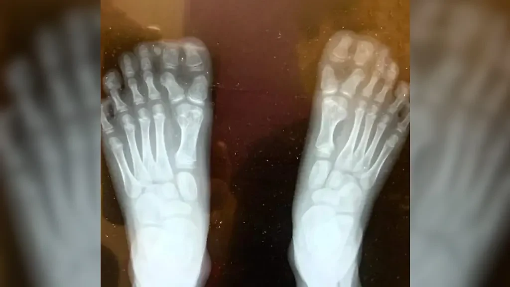 Фото © Reddit / jsams18