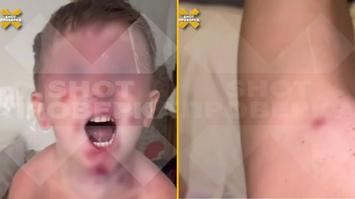 Семья из России поцепила странное заболевание на Бали. Фото © Telegram / SHOT ПРОВЕРКА