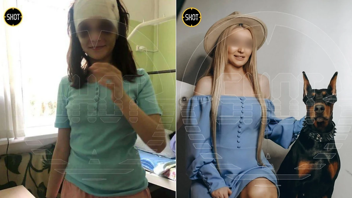 Пострадавшая девочка и нападавшая. Обложка © Telegram / SHOT