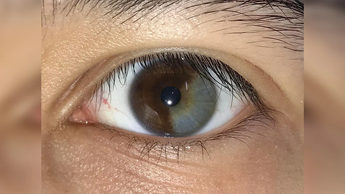 Фото © Reddit / Nico_LaBras