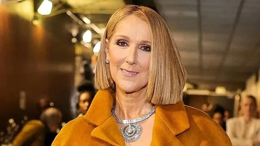 Певица почти не контролирует свои мышцы. Фото © Instagram (признан экстремистской организацией и запрещён на территории Российской Федерации) / celinedion