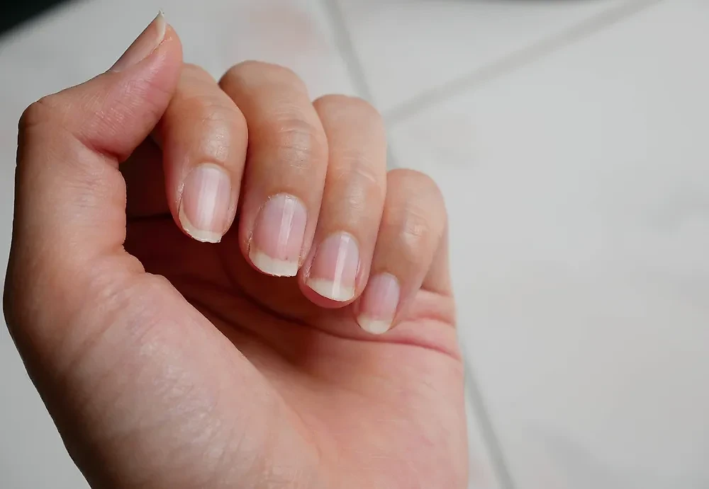 Продольные полосы на ногтях: что это значит? Фото © Shutterstock / FOTODOM / meow wii