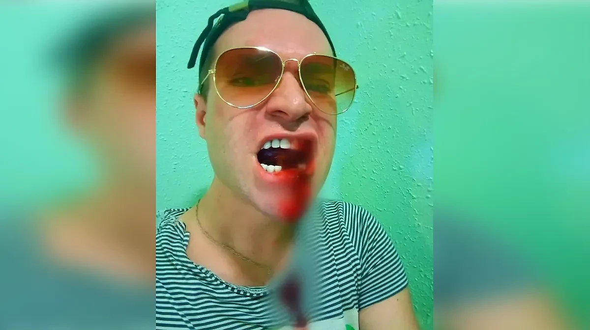 Избитый Гоген Солнцев собирается судиться с женой, чей любовник выбил ему зубы. Фото © Instagram (соцсеть запрещена в РФ; принадлежит корпорации Meta, которая признана в РФ экстремистской) / solntcev