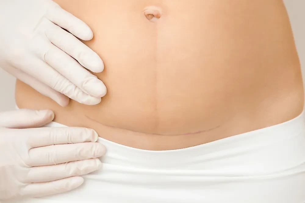 Правда ли, что "кесарята" отличаются от других детей? Фото © Shutterstock / FOTODOM / FotoDuets