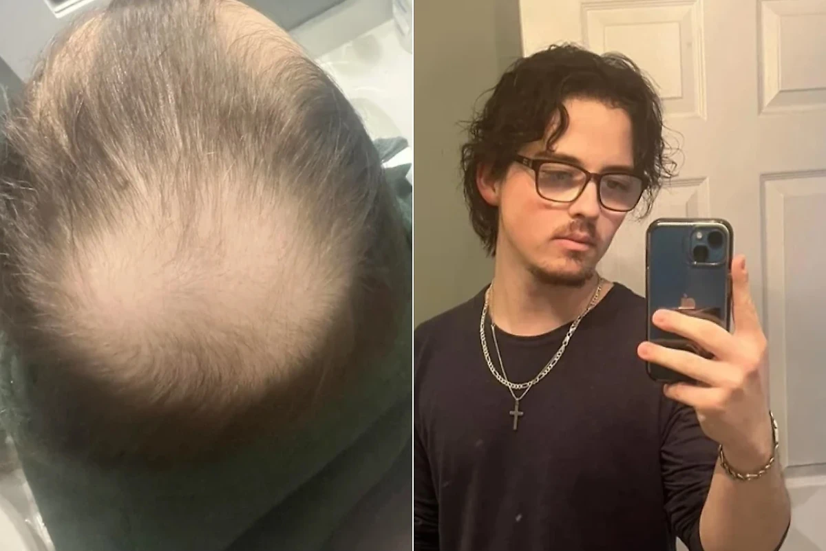 Фото © Reddit / orangecabbages1234