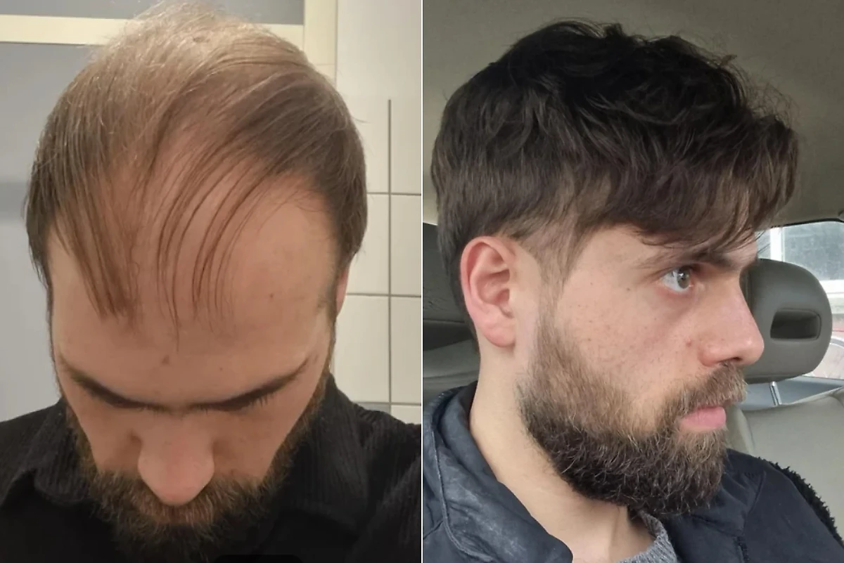 Фото © Reddit / AnteaterStreet7710