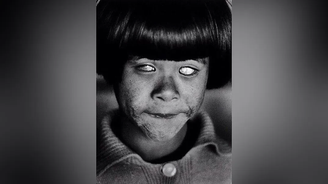 Фотография неизвестной девочки, видевшей взрыв ядерной бомбы в 1945 году. Фото © Telegram / История человечества