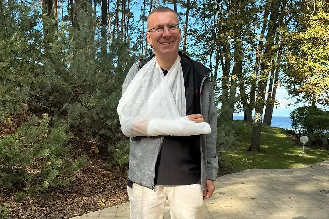 Президент Латвии Ринкевич сломал запястье и пальцы при падении с велосипеда. Обложка © X / edgarsrinkevics