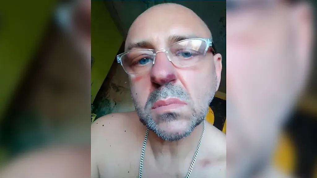 Новых пятен у Зазули с каждым днём становится всё больше и больше. Фото © kp.ru