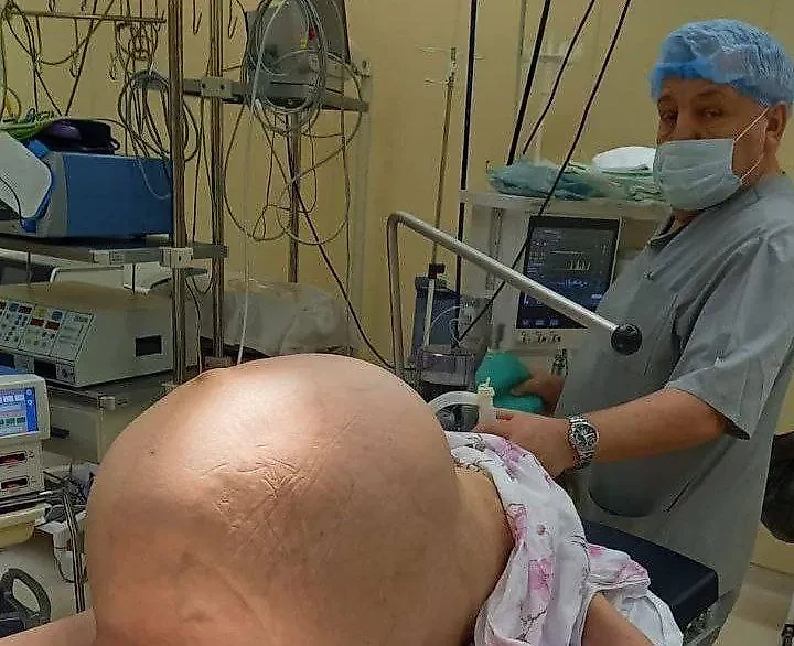 Россиянке удалили 40-литровую опухоль. Фото © Telegram / "Медицинская Россия"