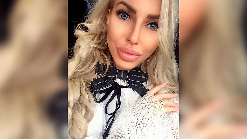 Когда модификация тела переходит границы безопасности. Фото © Instagram (соцсеть запрещена в РФ; принадлежит корпорации Meta, которая признана в РФ экстремистской) /  anella_an_