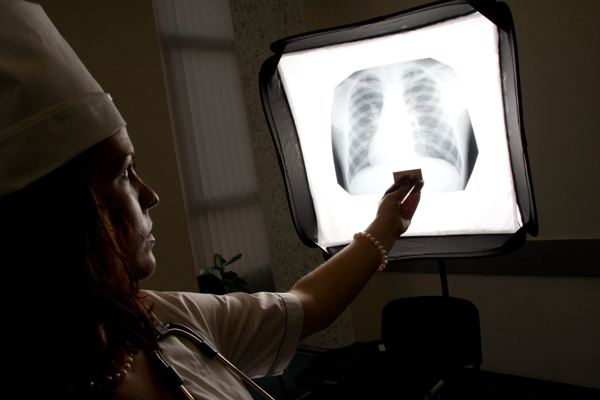 При микоплазмозе не всегда развивается пневмония. Исключить её можно, получив направление на КТ или рентген. Фото © Shutterstock 