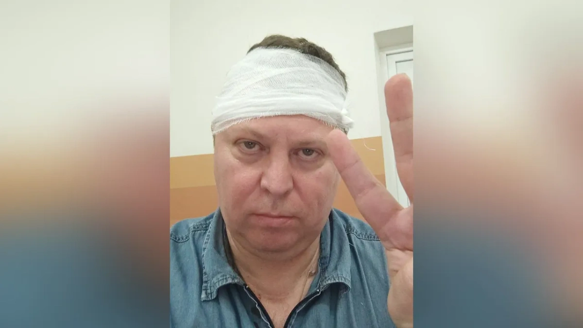 Депутат Михаил Матвеев после нападения. Обложка © Telegram / "Михаил Матвеев коммент"