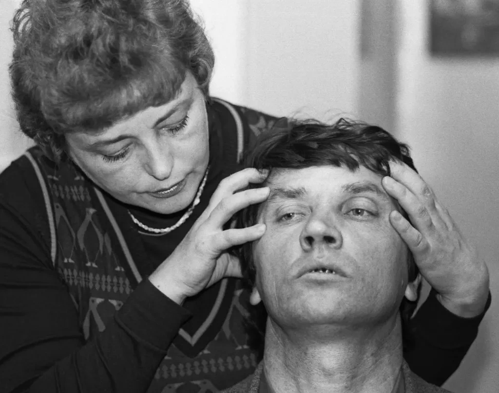 Ещё одной панацеей в 1970-х годах вдруг был объявлен акупунктурный массаж. Фото © ТАСС / Роберт Нетелев