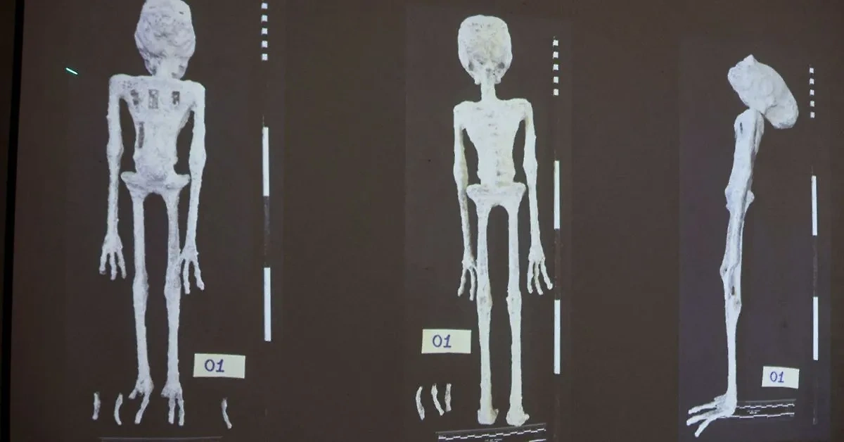 Рентгенологическое исследование мумий "гуманоидов", найденных в Перу. Фото © X / CNA