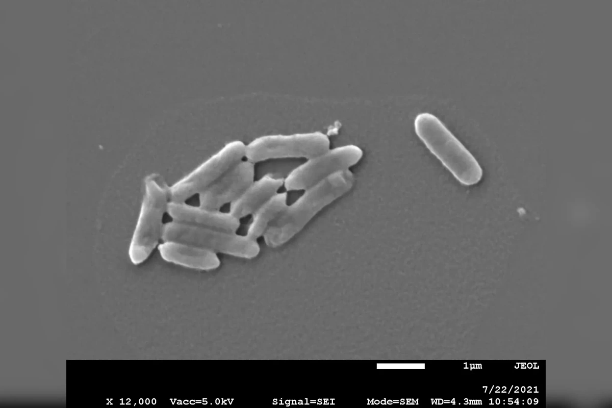 Бактерии-экстремофилы Acidithiobacillus ferrooxidans под микроскопом. Фото © cambridge.org