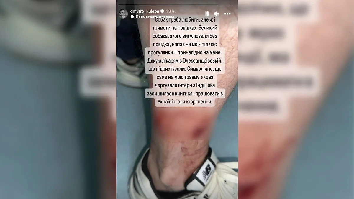 Дмитрий Кулеба показал укус собаки. Фото © Instagram (соцсеть запрещена в РФ; принадлежит корпорации Meta, которая признана в РФ экстремистской) / dmytro_kuleba