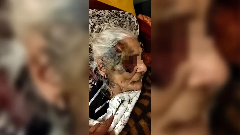 Пенсионерка получила множественные телесные повреждения в больнице Ставрополя. Фото © "Блокнот Ставрополь"