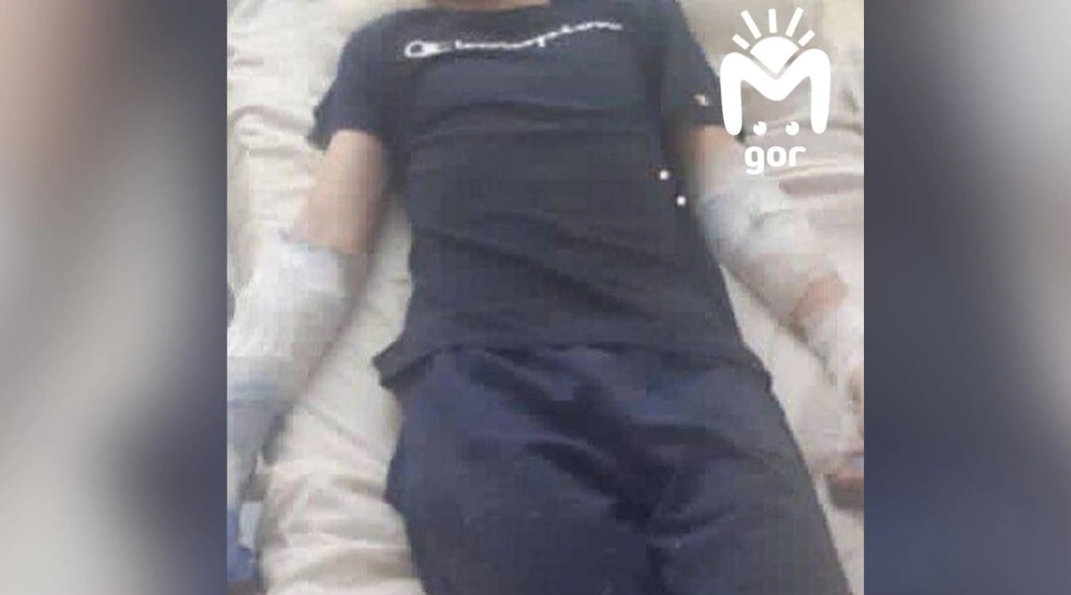 В Махачкале мальчик облокотился на дерево и лишился двух пальцев. Обложка © Telegram / Mash Gor