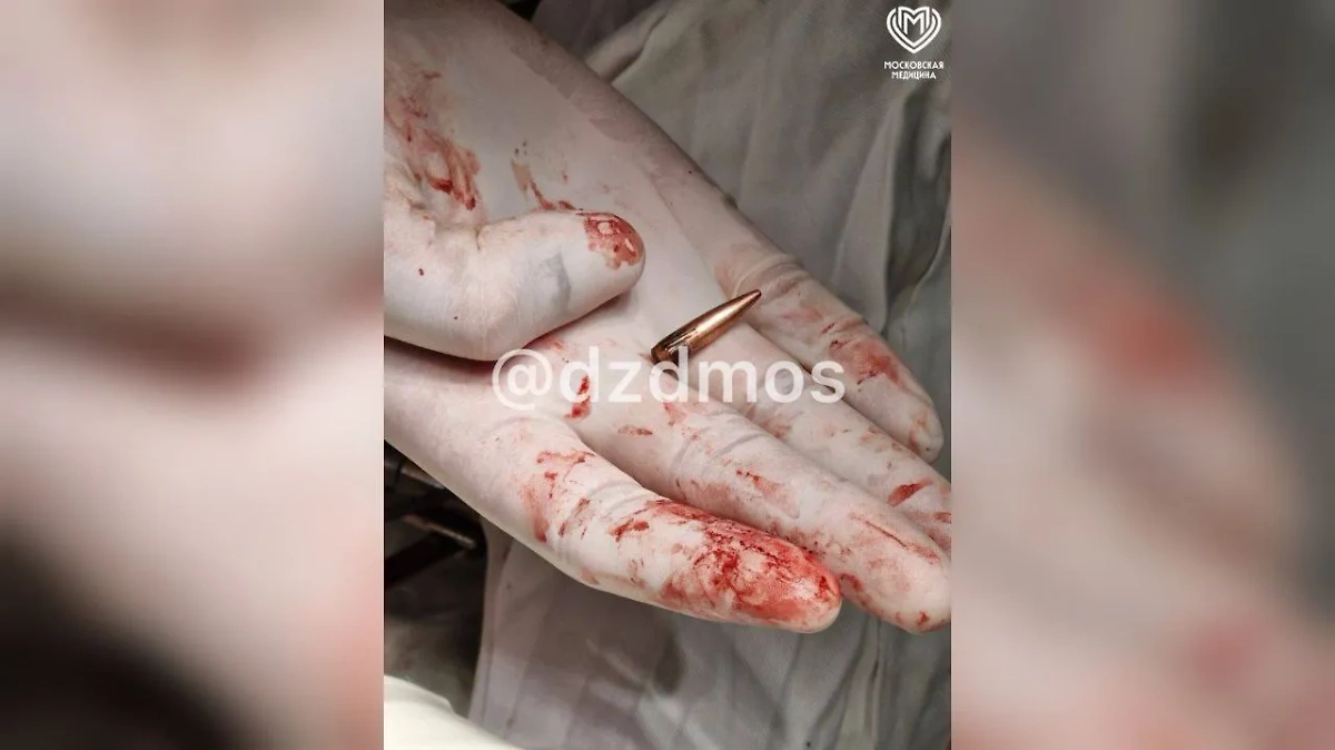 Из Курской области в Москву доставили раненного с пулей в вене. Фото © Telegram /  Московская медицина