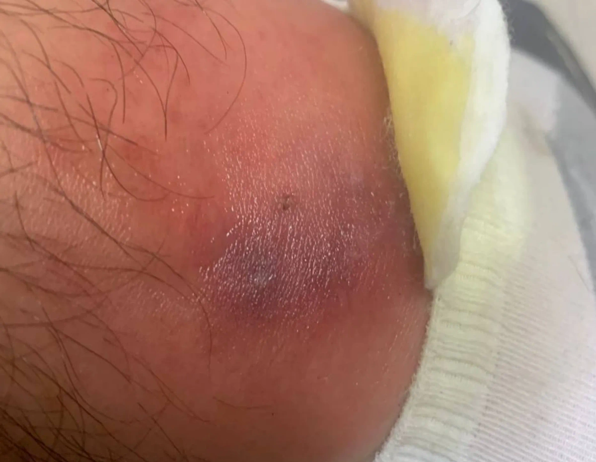 Фото ©&nbsp;Telegram / Москвач • Новости Москвы