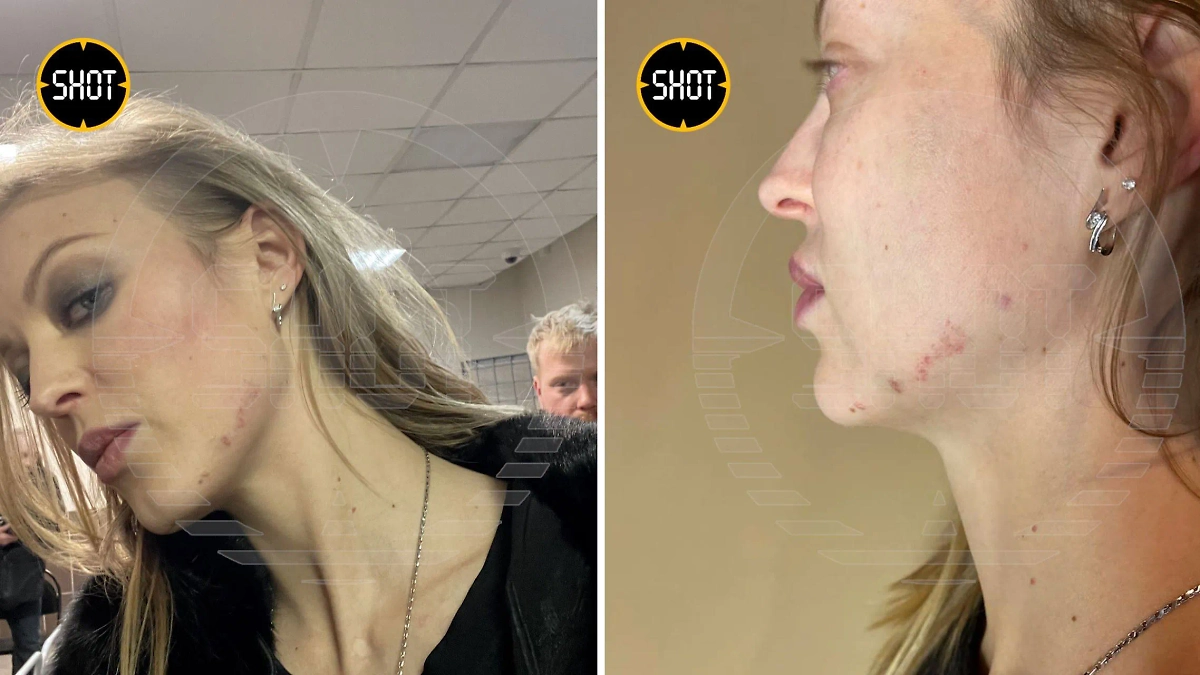 Последствия нападения незнакомца на Софию на концерте Гуфа. Фото © Telegram / SHOT