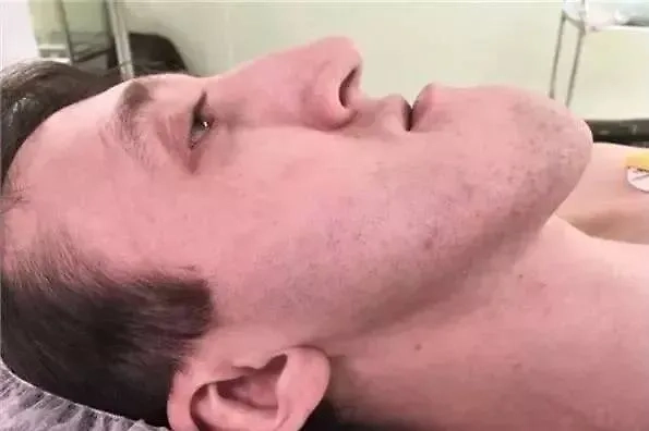 Так выглядело лицо Алексея до операций. Фото © VK / Красноярская краевая клиническая больница