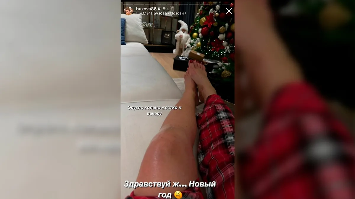 Ольга Бузова получила травму ноги у входа в офис. Фото © Instagram (соцсеть запрещена в РФ, принадлежит корпорации Meta, которая признана в РФ экстремистской) / buzova86